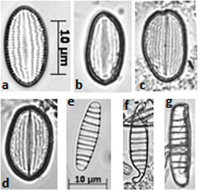 Ecological indicators and biological resources for hydrocarbon rhizoremediation in a protected area